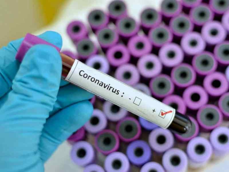 В Свердловской области на 25 мая рекордные 279 случаев коронавируса за сутки. Список городов