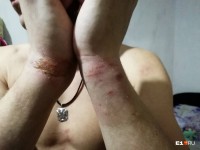 «На голову надели пакет и стали бить»: тагильчанин обвиняет полицейских в пытках (фото)