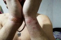 33-летний тагильчанин, обвинявший полицейских в избиении и пытках, госпитализирован