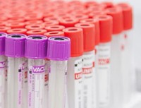 В Нижнем Тагиле заработала лаборатория, которая позволит проводить тесты на коронавирус