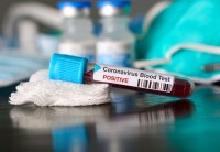 В Нижнем Тагиле подтверждён первый случай коронавируса