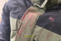 В Нижнем Тагиле старшеклассник-кикбоксер избил ученика восьмого класса