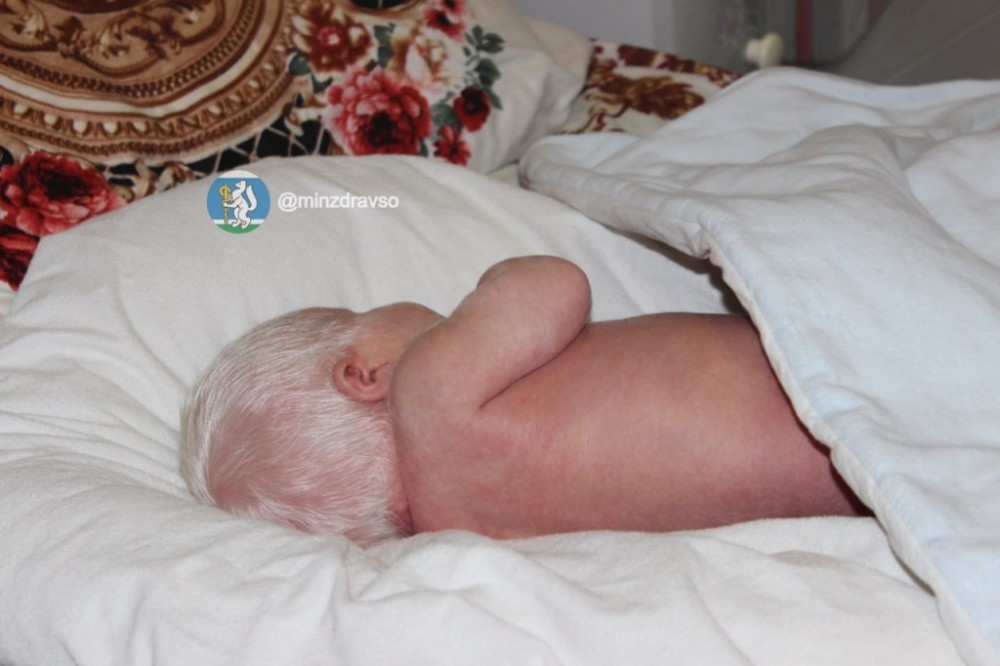 За 25 лет не видели подобного: в Тагиле родился уникальный мальчик